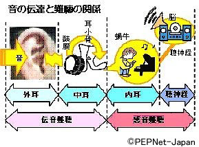 図　音の伝達と難聴の関係